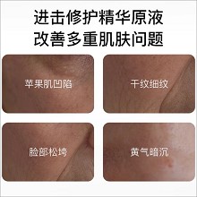 拉普瑞斯 玻尿酸凝萃精华原液30ml(补水保湿1号原液)深层保湿、淡化黑色素、提亮肤色、减少泛红、改善敏肌