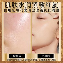 安婕妤 臻美金纯化妆水120ml 补水保湿、紧实弹嫩、赋活淡纹、水嫩滋养、细腻丝滑、改善干燥