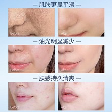克莱氏 净颜平肤精华露100ml(净化美颜液)减轻炎肌、平衡水油、收细毛孔、改善油光/痘痘/粉刺肌肤