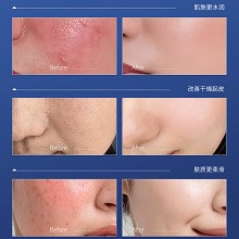 克莱氏 净颜菁纯乳霜50g 抑制脓肿痘痘、改善薄而潮红脆弱敏肌、提升肌肤修护力、强韧受损屏障